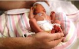 پیشرفت‌های بهداشتی امکان بقای نوزادان نارس را افزایش داده است